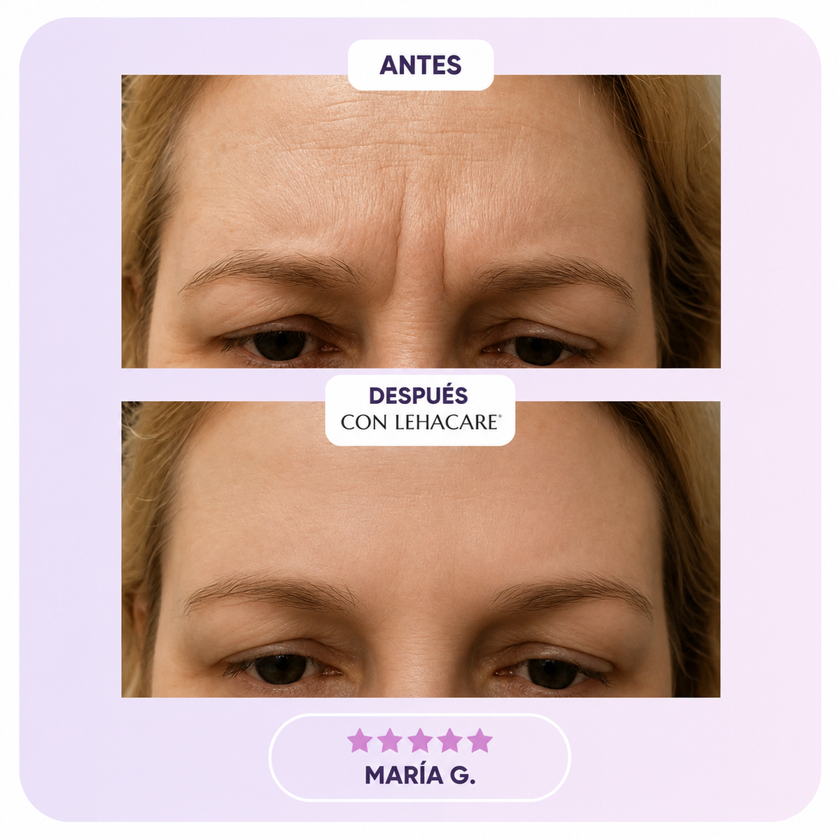 Lehacare™ Parche de Silicona con Colágeno
